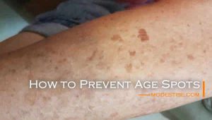 how to prevent liver spots